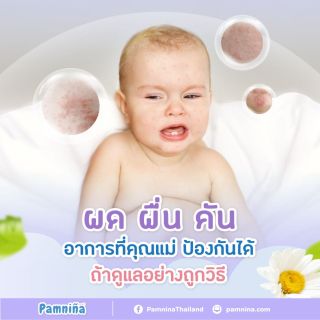 ผดผื่นคันลูกน้อย อาการแพ้เล็กๆ ที่คุณแม่ป้องกันได้ ถ้าดูแลอย่างถูกวิธี